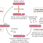 How to Recover Muscles After Playing Football Effectively