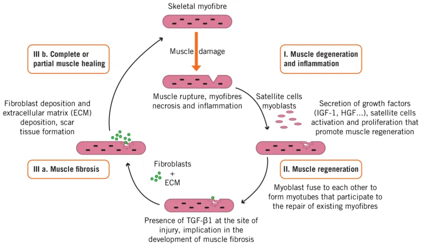 How to Recover Muscles After Playing Football Effectively